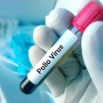 Polio Virus Found in Four Additional Environmental Samples