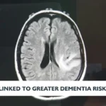 Could Anxiety in Older Adults Be a Hidden Risk Factor for Dementia? Complete Research Is Given…