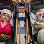 Miraculous Separation: Pakistani Conjoined Twins Thrive After Surgery in Turkey