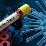 Two More Children Paralysed by Poliovirus in Pakistan